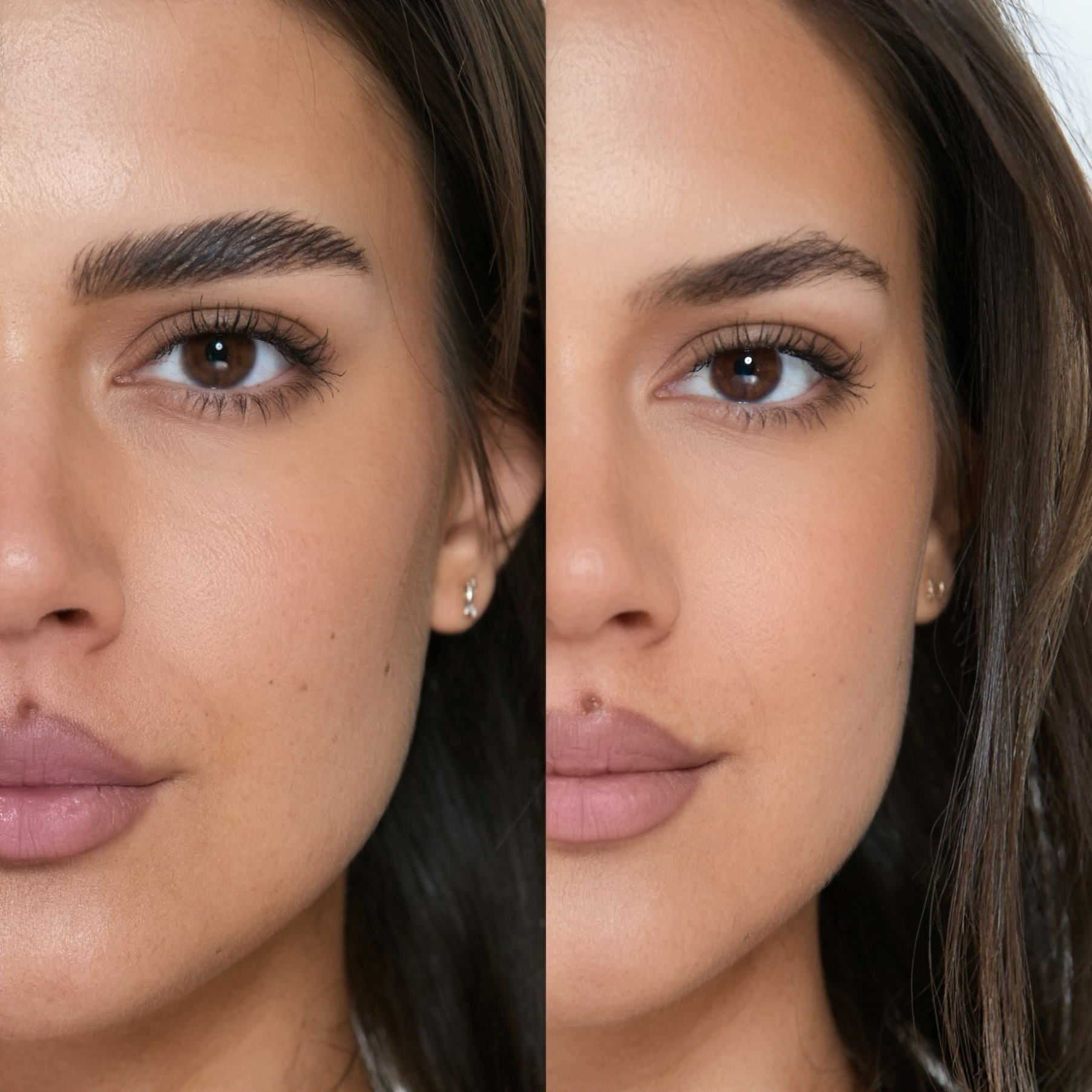 CYSTEAMINE FIX STEP 2 (15ml)